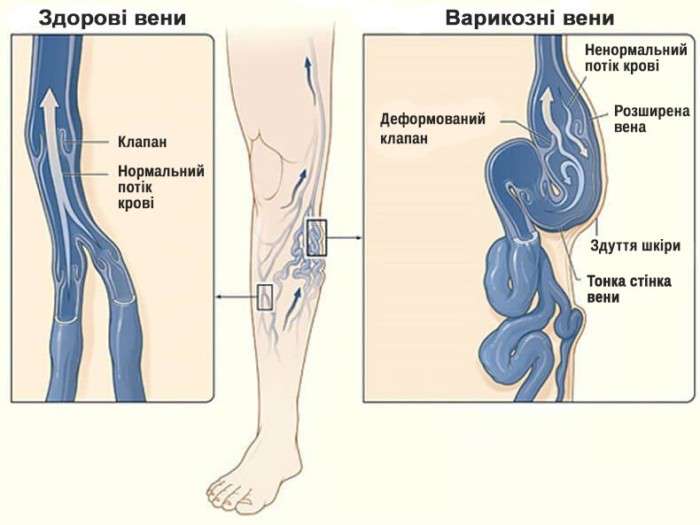 Від Тарнополя до Тернополя