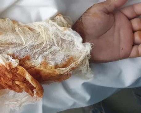 Від Тарнополя до Тернополя