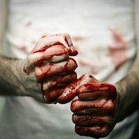 Житель Березовиці до смерті забив 46-річного чоловіка