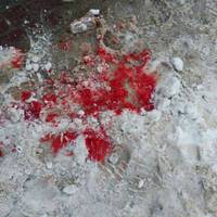 Нападника на екс-депутата Ігоря Турського викликають до суду
