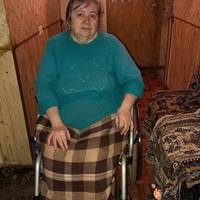 Потрібна допомога: в матері хвороба заживо зїдає ноги, а дочка — на інвалідному візку (Фото 18+)