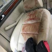 У Почаєві шукають свідків загадкової ДТП, у якій постраждав чоловік (ФОТО)