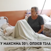 Львівські медики рятують 7-річного Максимака, який вижив після вибуху на вул. Пушкіна у Тернополі (ВІДЕО)