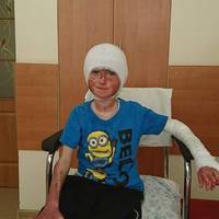 Тернополян просять допомогти хлопчикові, який постраждав від вибуху в квартирі (ФОТО)
