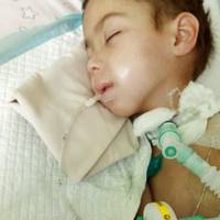 На Тернопільщині дитина перебуває у комі від ускладнень після кору