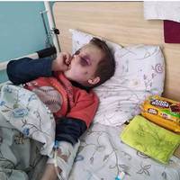 Через гематоми нічого не бачить: батьки по-звірячому побили 6-річного хлопчика (Фото)