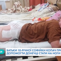 Небайдужих тернополян просять допомогти зібрати кошти на операцію для 10-річної Софійки Копач. Відео