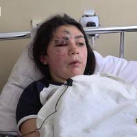Подробиці жахливої ДТП за участі авто патрульних і “Мазди” на Тернопільщині. ВІДЕО