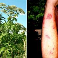 Небезпечна рослина масово розростається на Тернопільщині