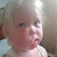 Під час вагітності вдарив дружину в живіт: у мережі просять допомогти прооперувати дитину з Тернопільщини