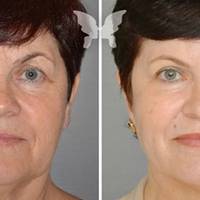 Шкіра в 64, як в 40! Жінка поділилася рецептом молодості …