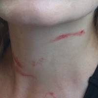 На Тернопільщині медсестра побила маму, яка захищала свого сина (ФОТО 18+)