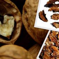 Вона залила окропом перегородки горіха і приймала цей настій щодня! Результат здивував навіть лікаря