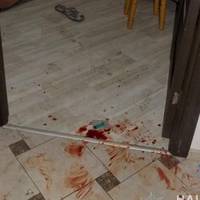 У Тернополі троє студентів жорстоко побили та пограбували африканця (фото)