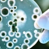 Фахівці не підтвердили діагноз сибірської виразки на Тернопільщині