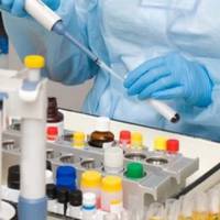 Сибірка в дитини з Тернопільщини: у київській лабораторії захворювання не підтвердили