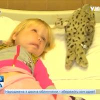 Про Надійку з пухлиною на обличчі розповіли у відомому телевізійному шоу (Відео)