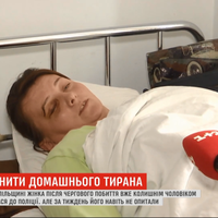 Вибив зуба та поставив синець під оком. Мати трьох дітей переховується від колишнього чоловіка