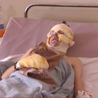 Лікарі розповіли про стан дітей, котрі постраждали від вибуху в клубі на Тернопільщині