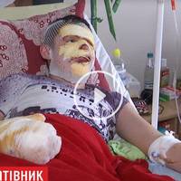 Горів сам, але витяг з вогню товариша: геройський вчинок підлітка з Тернопільщини (ВІДЕО)