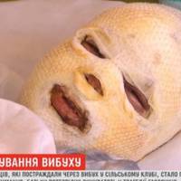 Стан деяких постраждалих після вибуху в селі Угринів досі важкий