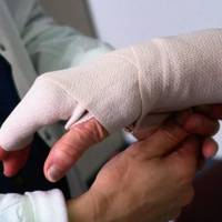 Відомий хірург з Тернопільщини безкоштовно прооперує дівчинку, яку підпалив батько