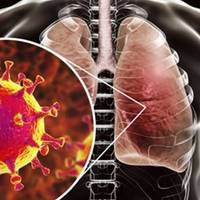 КОРОНАВІРУС ВЖЕ В УКРАЇНІ: ПЕРШИЙ ВИПАДОК ОФІЦІЙНО ЗАРЕЄСТРОВАНО У ЧЕРНІВЦЯХ (ОНОВЛЕНО)