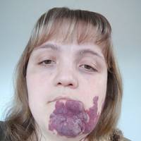 “Дітям потрібна здорова мама”. Допоможіть зібрати гроші на операцію жительці Теребовлі