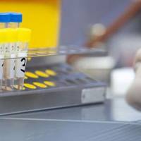 Нарешті! Тест-системи для визначення коронавірусу вже є у Тернополі