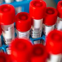 У тернопільську лікарню госпіталізовано ще одного пацієнта з підозрою на коронавірус