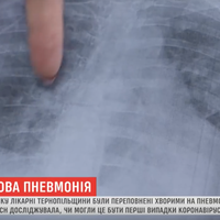У СІЧНІ НА ТЕРНОПІЛЬЩИНІ БУЛО БАГАТО ХВОРИХ НА ПНЕВМОНІЮ: ЧИ БУВ ЦЕ КОРОНАВІРУС