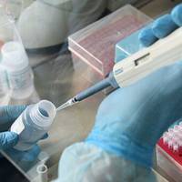 Мобільні групи на Тернопільщині будуть проводити тестування на COVID-19