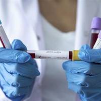 Коронавірус підтвердили у 25-річної тернополянки