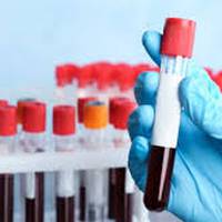 У 90-річної жительки Тернопільщини діагностували коронавірус: як протікає захворювання (ВІДЕО)