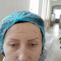 «Припиніть нас обманювати!» – медсестра з Тернопільщини розповіла на телебаченні про маніпуляції з доплатами (Відео)