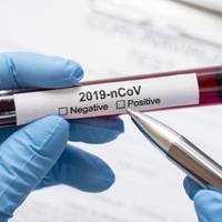 У Тернополі коронавірус виявили у п’ятьох людей