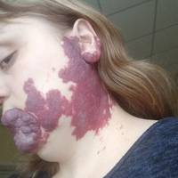 Щоб врятувати життя молодій мамі з Теребовлі, потрібно 25 тисяч доларів