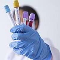 У Тернополі обстежили 300 працівників садочків, експрес-тест у трьох випадках дав позитивний результат (фото)