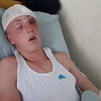 Вибігли з бітами, побили і втекли: на Тернопільщині жорстоко розправилися з підлітками (ФОТО)