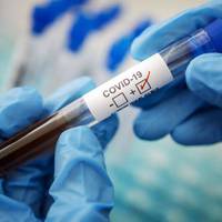 На Тернопільщині проведено 146 ПЛР- досліджень та виявлено 19 хворих на коронавірус