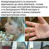 3-річна дитина з опіками потрапила до лікарні, бо її вдарило струмом