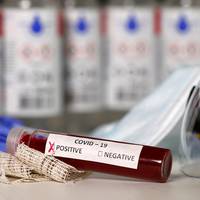 Україна побила страшний рекорд по коронавірусу: дані на 18 червня