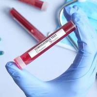 Ще 17 жителів Тернопільщини «підхопили» коронавірус