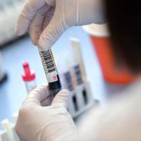 Коронавірус на Тернопільщині: +28 хворих за добу