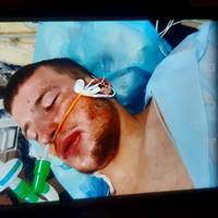 На Тернопільщині по-звірячому розправилися з 22-річним молодиком, він у реанімації