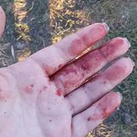 “Дівчина стояла біля мосту із порізаними руками”: тернополянка хотіла накласти на себе руки (ВІДЕО)