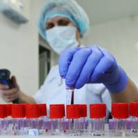 На Тернопільщині підтвердили 2108 випадків COVID-2019 (станом на 7 липня)