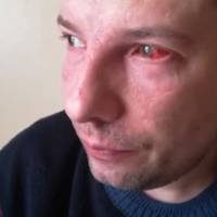 “Знищене здоров’я”: у Тернополі пара потерпає через постійні напади та погрози (ВІДЕО, 18+)