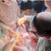 “Вперше за 15 років”: тернопільський лікар блискуче провів пересадку серця (ВІДЕО)