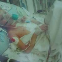 Сироті з Тернопільщини потрібна термінова операція (фото)